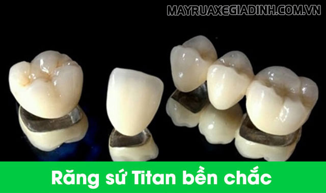 Titan được sử dụng làm răng sứ.